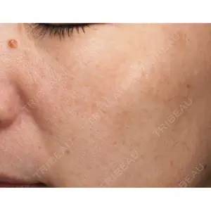 30 days after image