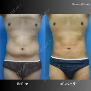 before image