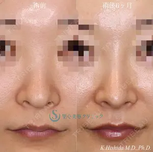 180 days after image