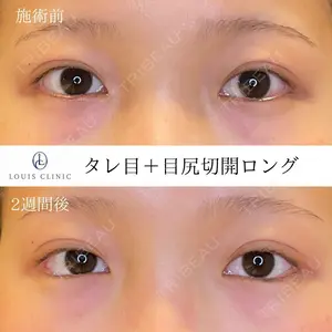 14 days after image