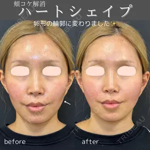 0 days after image
