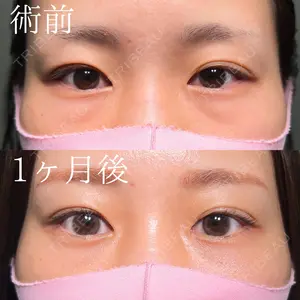 before image