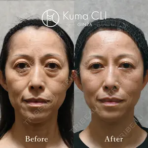 90 days after image