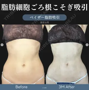 90 days after image