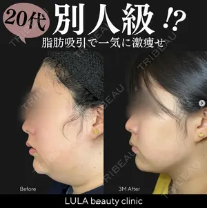 90 days after image