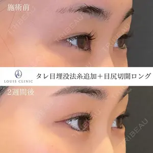14 days after image