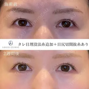 14 days after image