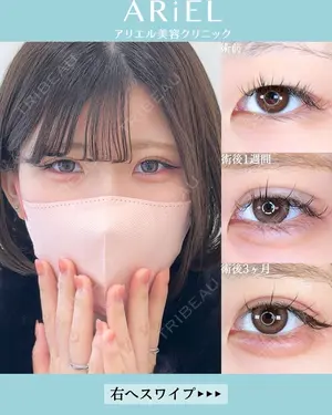 90 days after image