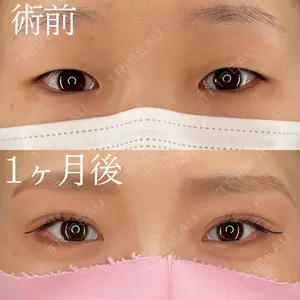 30 days after image