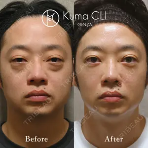 180 days after image