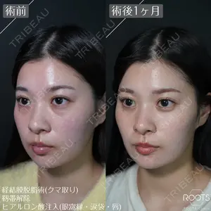 before image