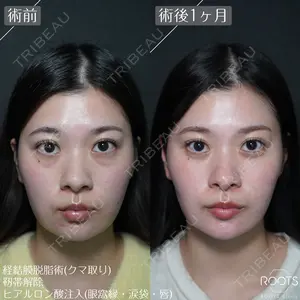 30 days after image
