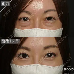 30 days after image