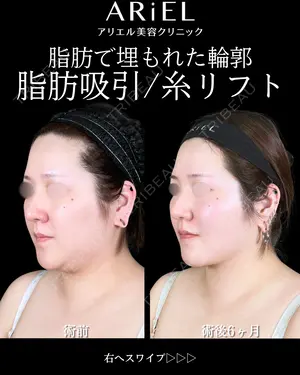 180 days after image