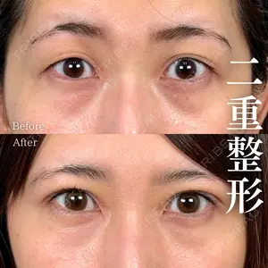 30 days after image