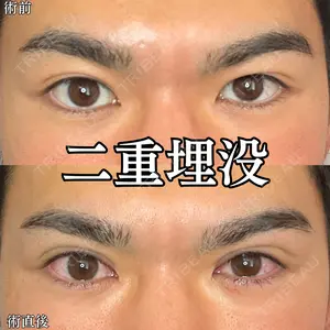 before image