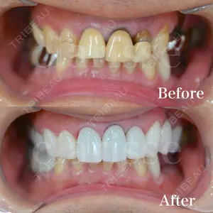 before image