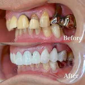 before image