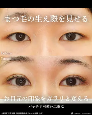 before image