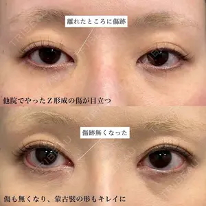 before image