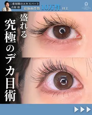120 days after image