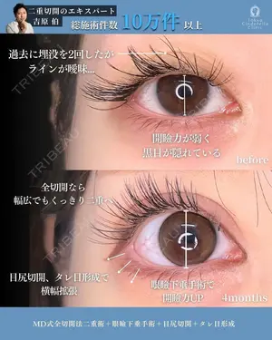 before image