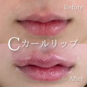 0 days after image