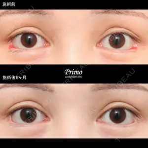 180 days after image