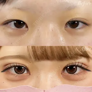 before image