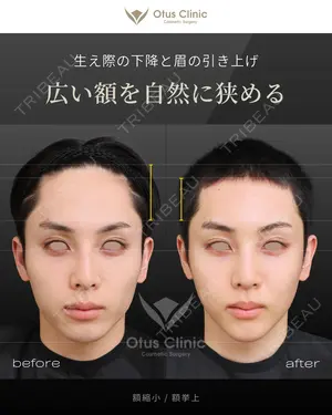 90 days after image