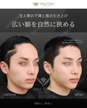 before image