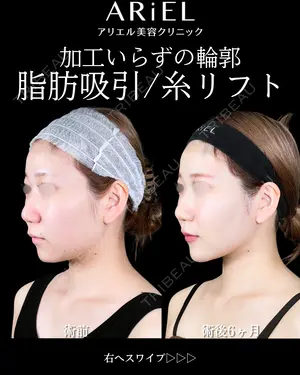 180 days after image