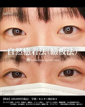 before image