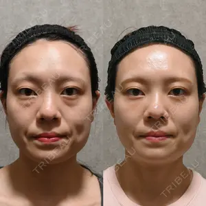 90 days after image