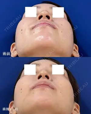 before image