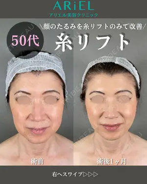 30 days after image