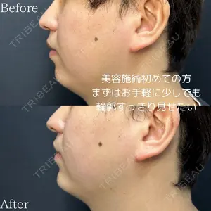 before image