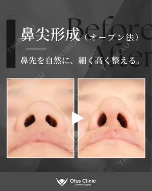30 days after image