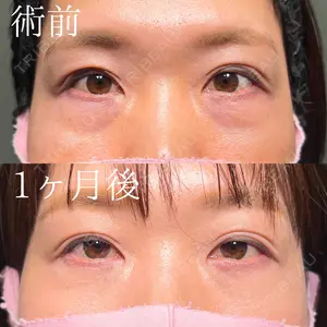 30 days after image