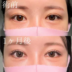 before image