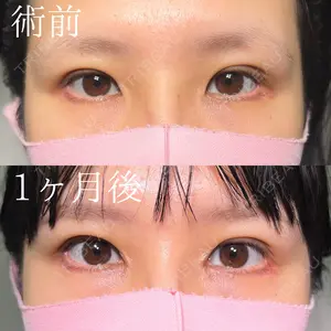 before image