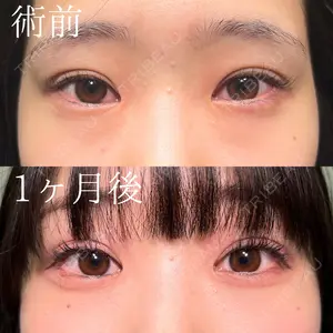 before image