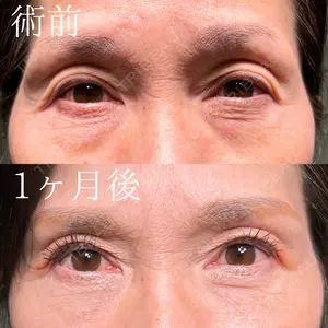 30 days after image