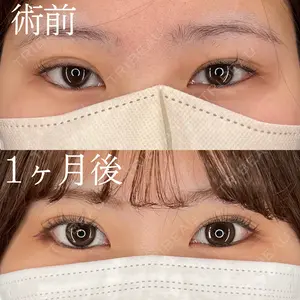 30 days after image