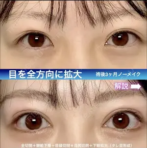 90 days after image