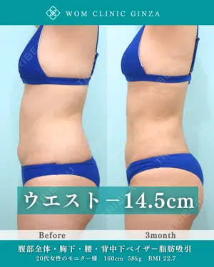 90 days after image