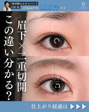 180 days after image
