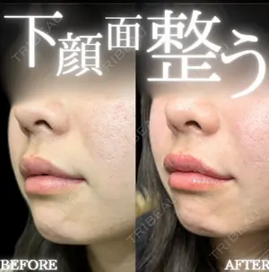 before image
