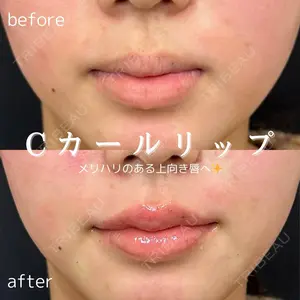 before image