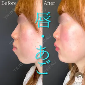 before image